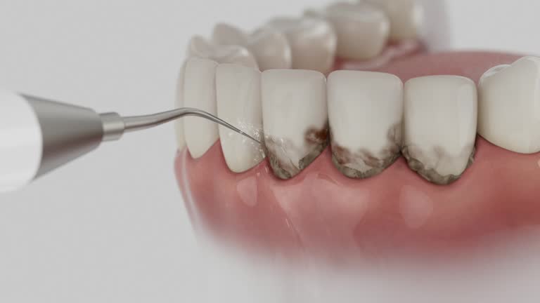 Trusted Emergency Dentist service in Catlin, IL - Dentist Open Now